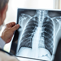 xray